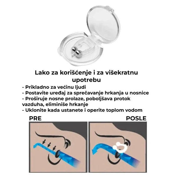 Prsten protiv hrkanja - Set 2 kom.